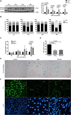 Nicotinamide Mononucleotide Attenuates Renal Interstitial Fibrosis After AKI by Suppressing Tubular DNA Damage and Senescence